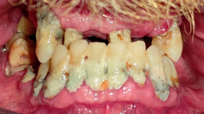 Tratamiento-Prótesis-fija-Antes-Personal-Dent